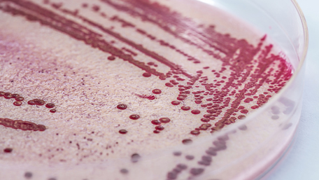 listeria